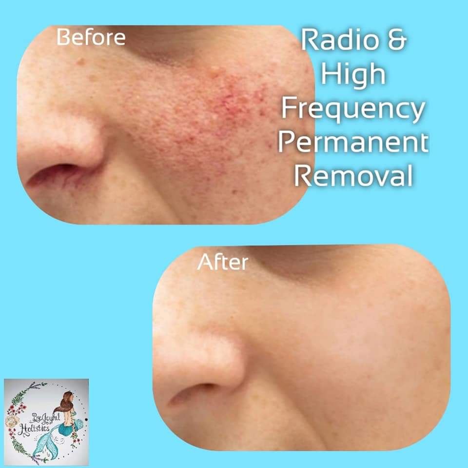 50% off 🎃60 Minute Treatment RHF