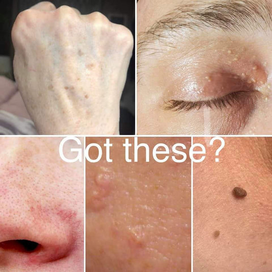 MM💚One Single Removal RHF